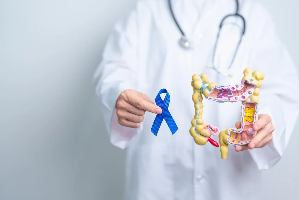 Cáncer de colon y recto en CDMX y Naucalpan: atención coloproctológica especializada